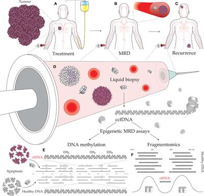 Epigenetic liquid biopsies for minimal residual disease, what’s around the corner?